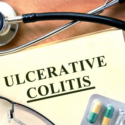 Ulcerative Colitis (ABI-M201-101) Ulcerative Colitis (ABI-M201-101)