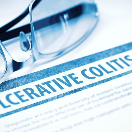 Ulcerative Colitis (M14-234) Ulcerative Colitis (M14-234)