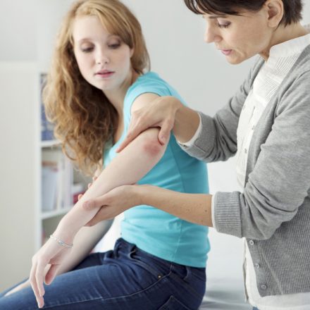Atopic Dermatitis/Eczema (I4V-MC-JAIW) Atopic Dermatitis/Eczema (I4V-MC-JAIW)